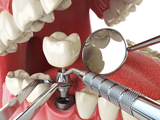 Best Emergency Care for Gum Disease in Manchester, OH